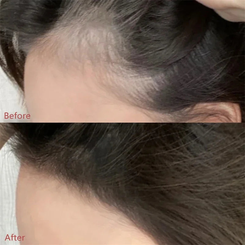 Hair Line Natural Coverage Powder Natural Instant Coverage Paint Repair Fill in Hair Waterproof Hairline Shadow Concealer Makeup  Repair Beauty Portable Tool